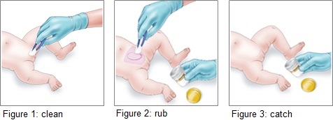 Urine samples